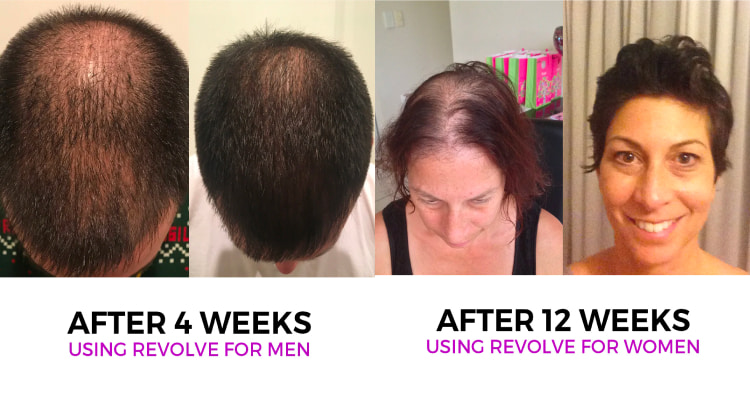Zenagen shampoo before and after